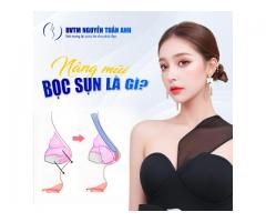 Nâng mũi bọc sụn tai có vĩnh viễn không?