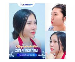 Nâng mũi cấu trúc sụn surgiform