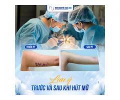 Hút mỡ cánh tay có an toàn và hiệu quả lâu dài không?