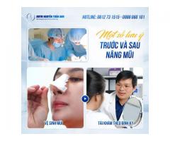 Vì sao cần phải sử dụng nẹp mũi sau phẫu?